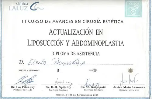 Liposuction 2003