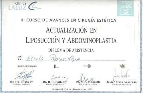 Liposuction 2003