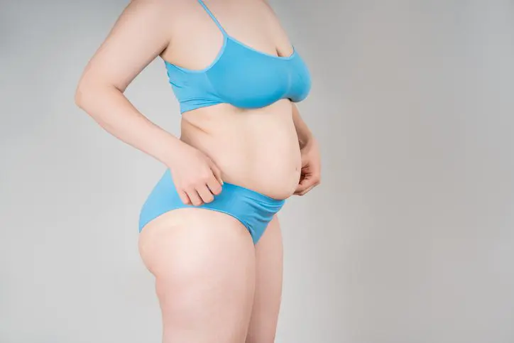 Flabby skin on a womens belly