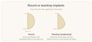 implant-shape-round-teardrop
