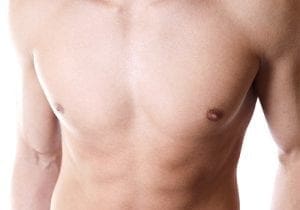 Male breast reduction surgery