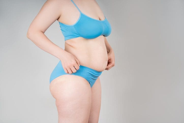 Flabby skin on a womens belly